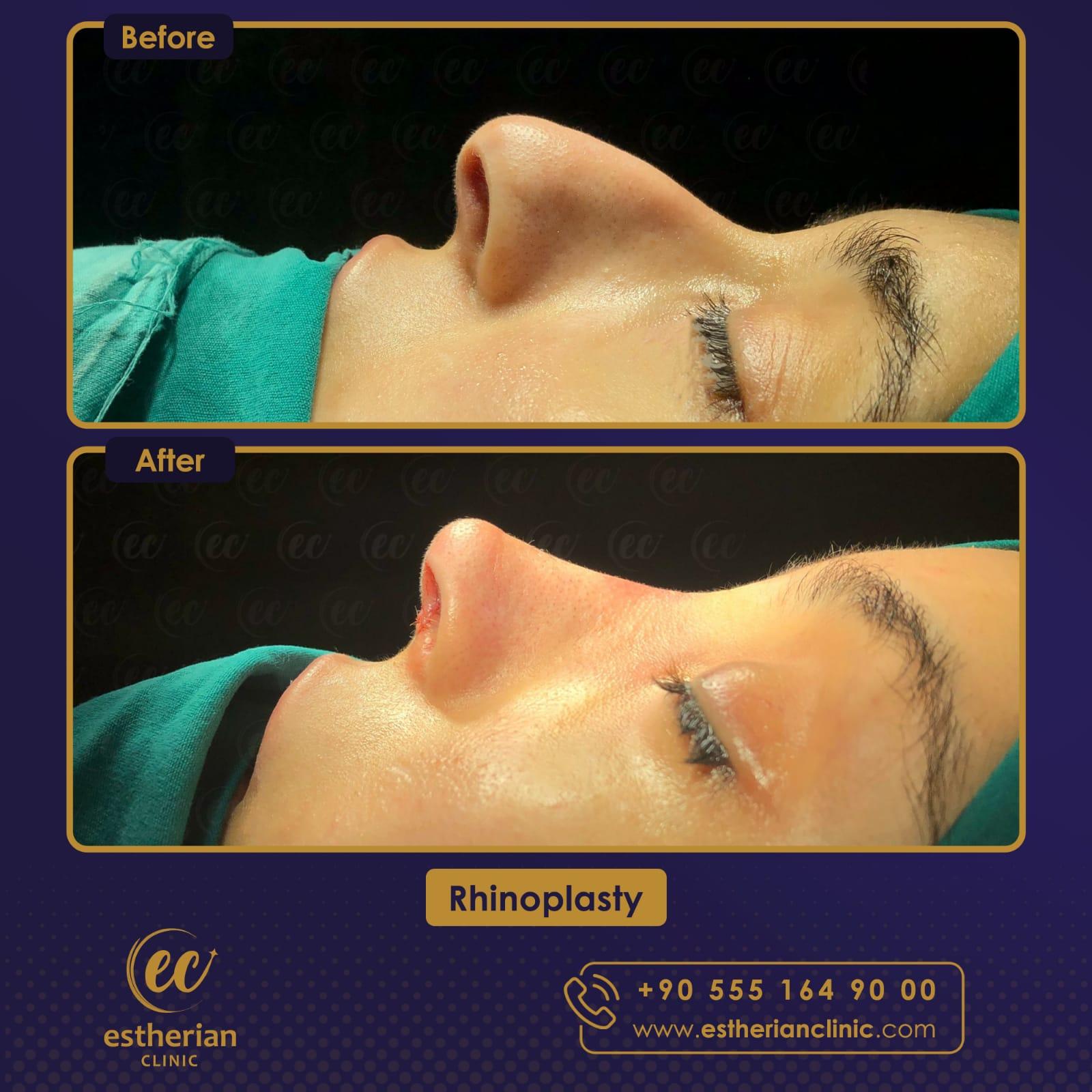 Estherian Istanbul on Esthetic Planet