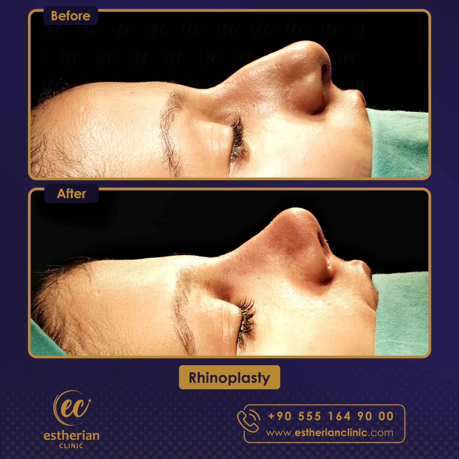 Estherian Istanbul on Esthetic Planet