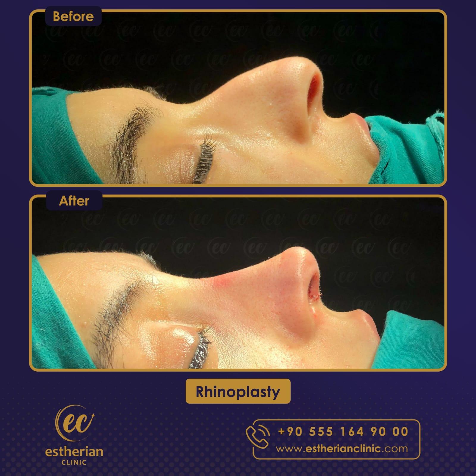 Estherian Istanbul on Esthetic Planet