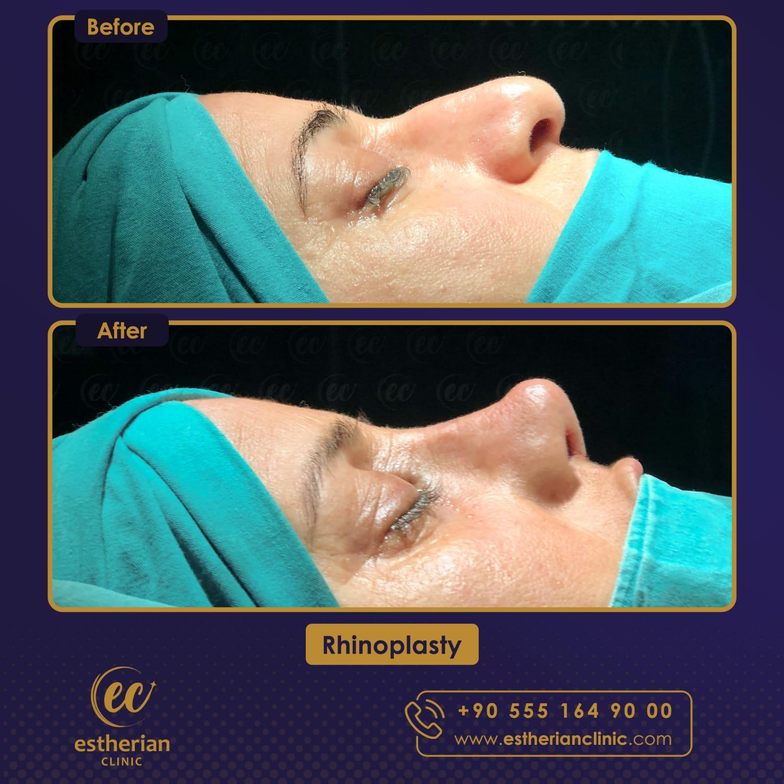 Estherian Istanbul on Esthetic Planet