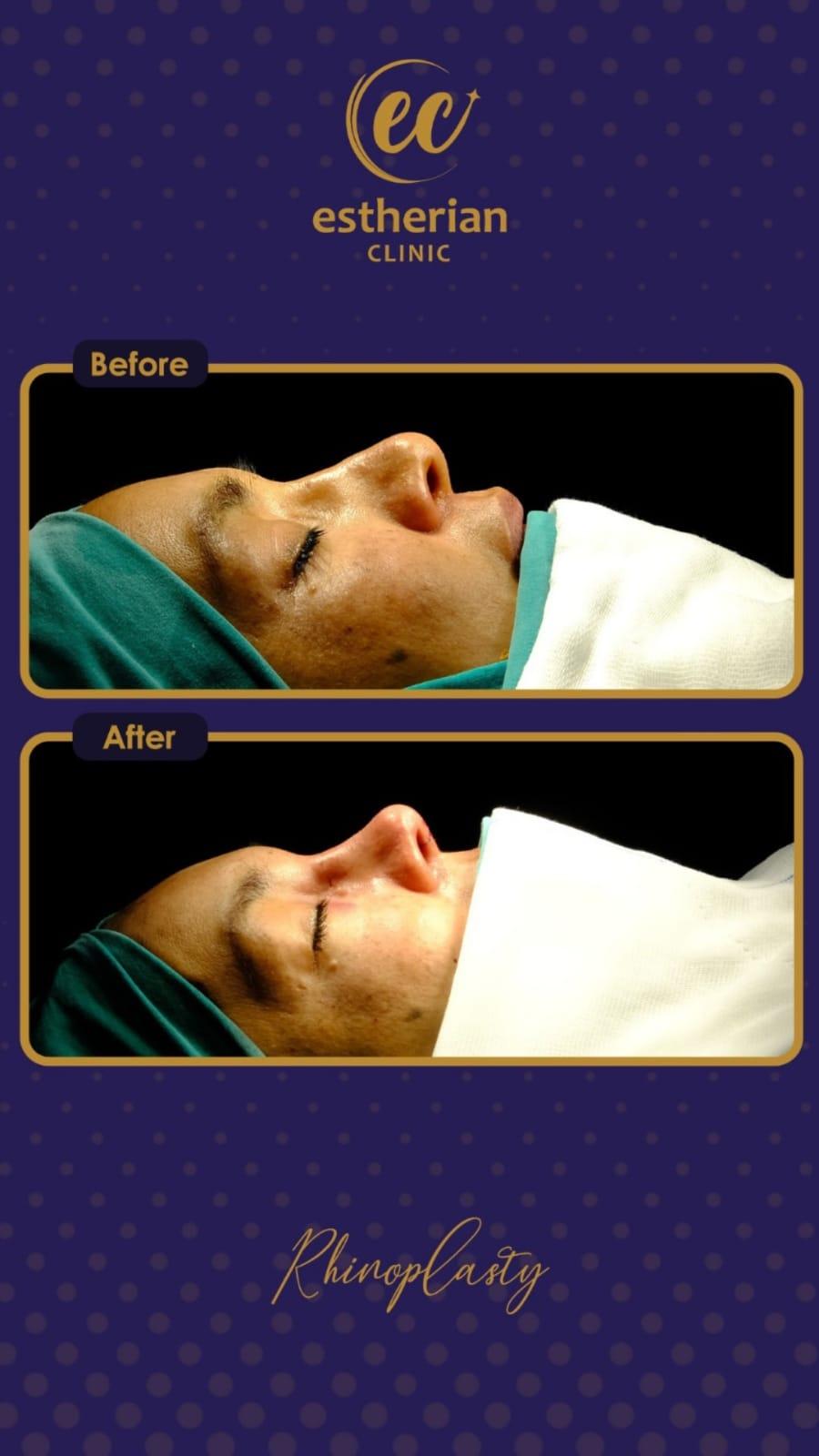 Estherian Istanbul on Esthetic Planet