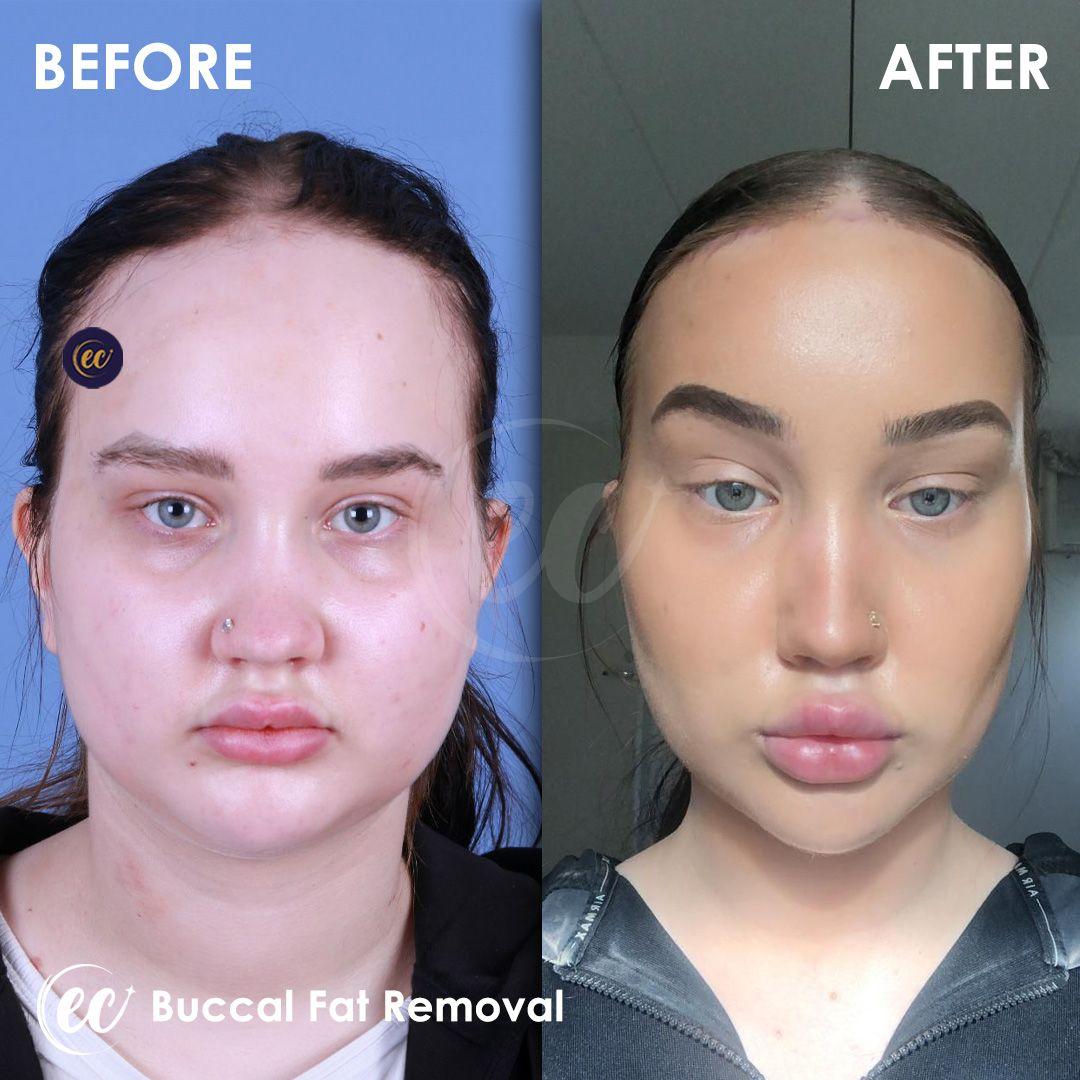 Estherian Istanbul on Esthetic Planet