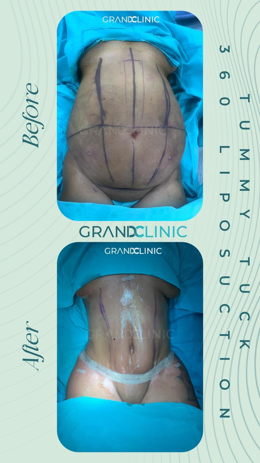 47d22aa0-98bf-4f06-aa78-b8fe093d820e