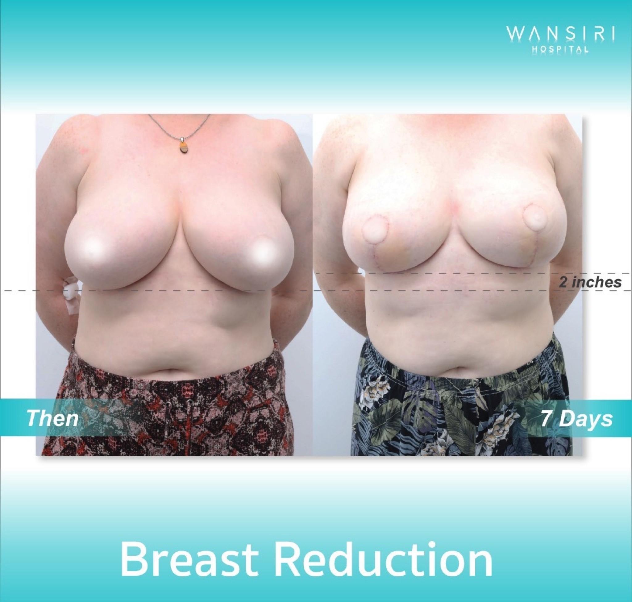 20250122_085414811_iOS