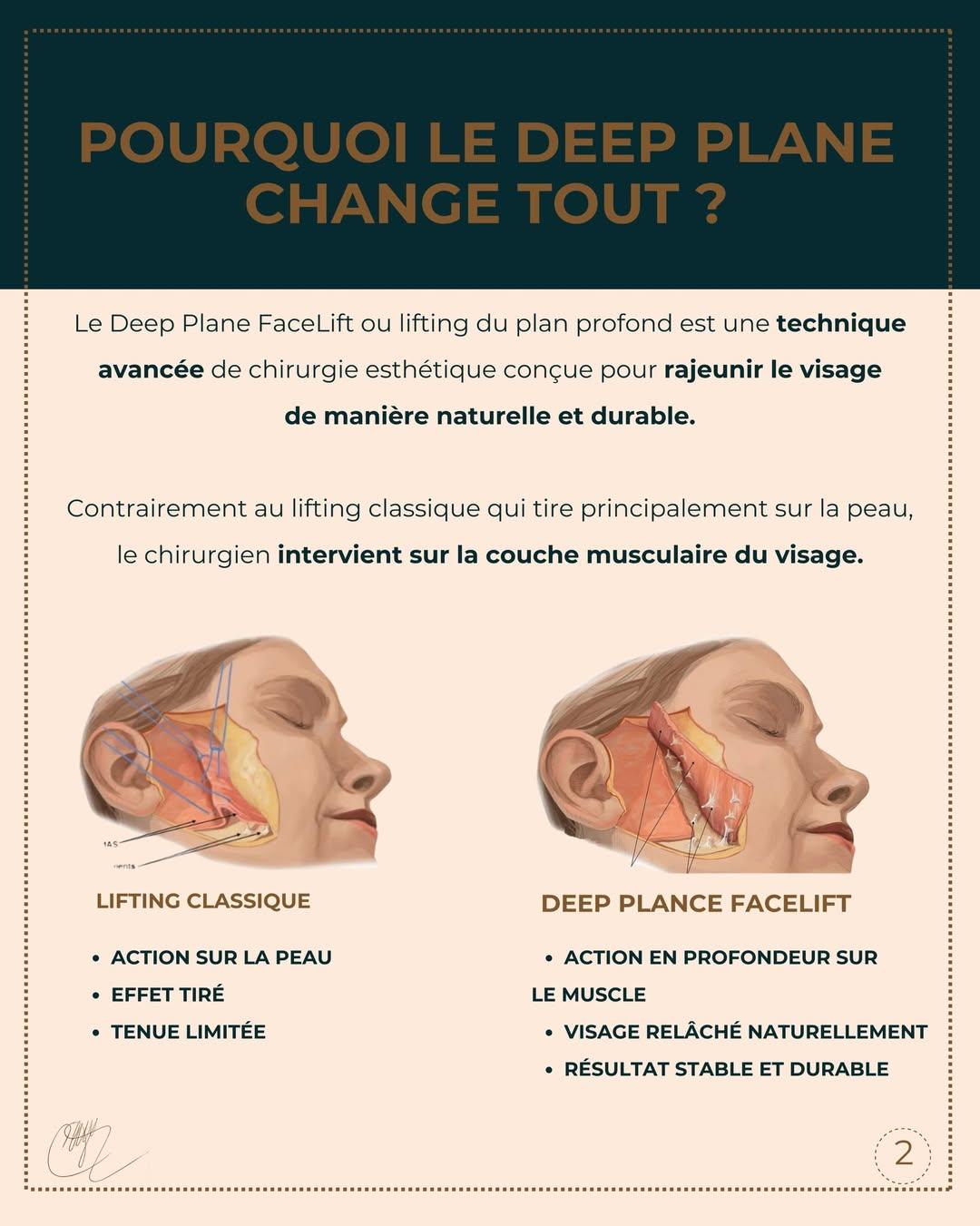 Deep Plane face lift