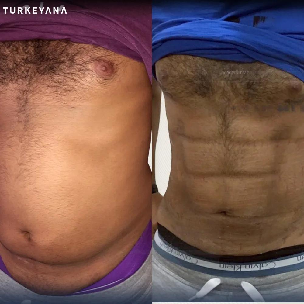 high def 6 pack Istanbul