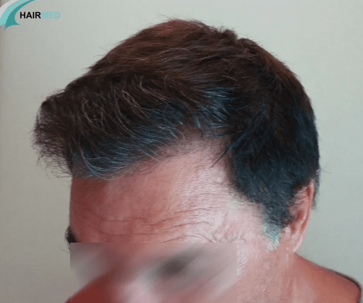 3800 FUE DR BEYHAN FRONT VIEW2