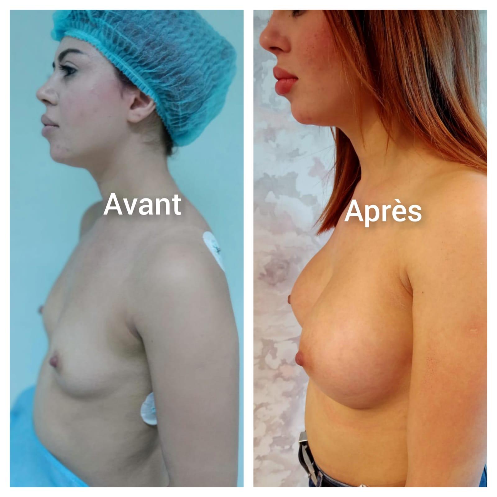 Zaghouan surgery results4