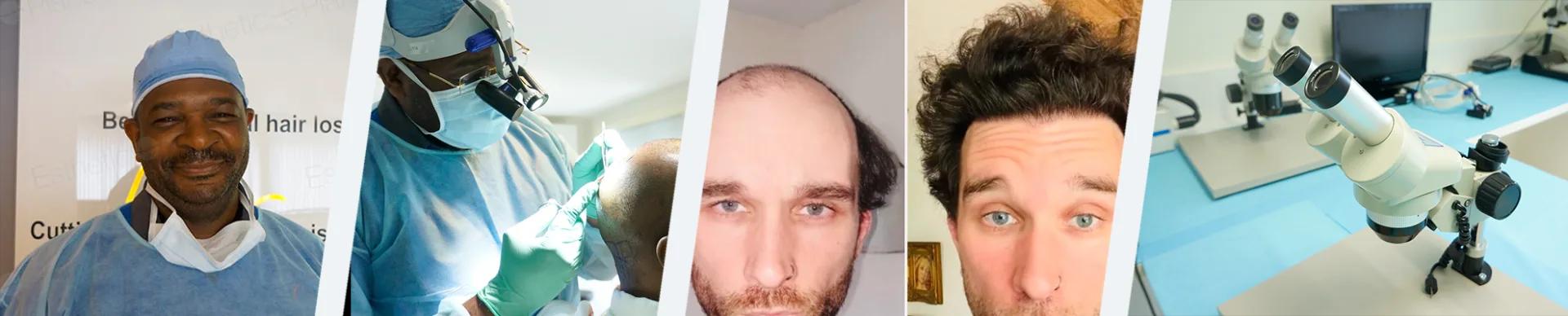 World Hair Transplant Center - Dr. Patrick Mwamba — Esthetic Planet