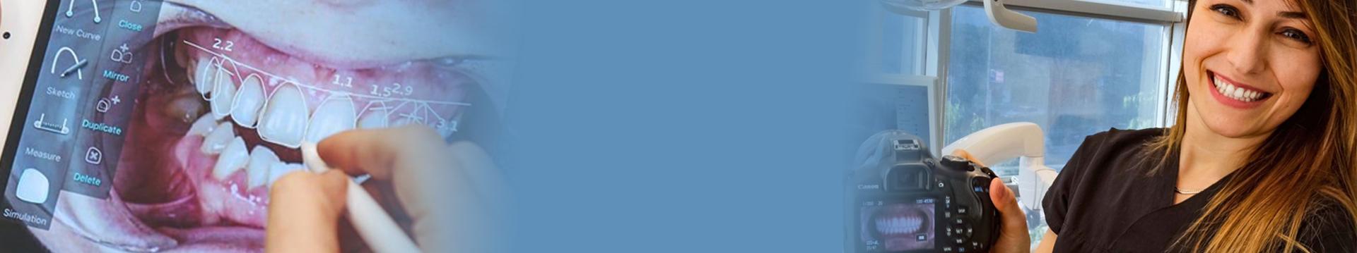 Guide to dental veneers banner