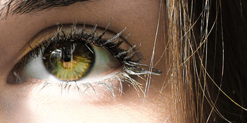 Blepharoplastie complète