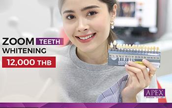 Teeth whitening