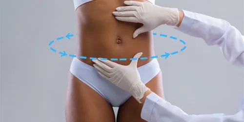 Lipo 360