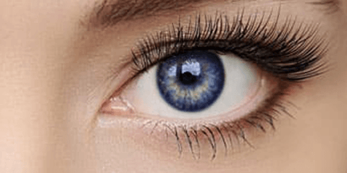 Blepharoplasty