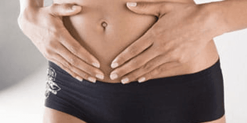 Tummy tuck