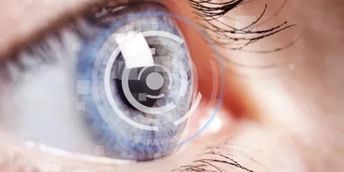Implantes multifocales