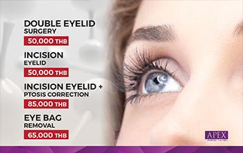 Blepharoplasty
