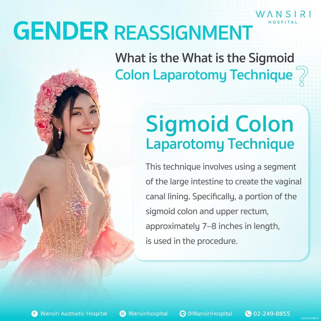 MTF Vaginoplastica con Innesto Colon Sigmoideo