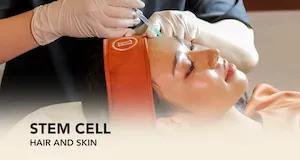 Cellules Souches pour le Cuir Chevelu