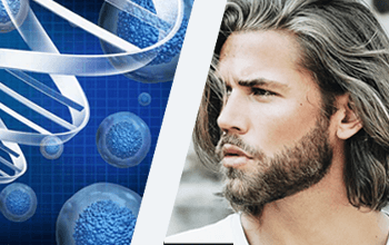 Trapianto di Capelli Cellule Staminali