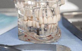 Straumann Dental Implant