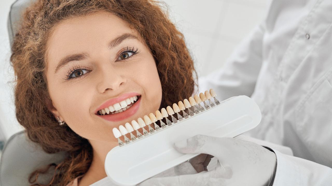 Faccette dentali