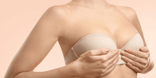 Lifting del seno con impianti