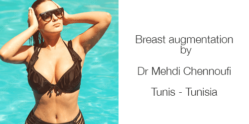 Augmentation Mammaire