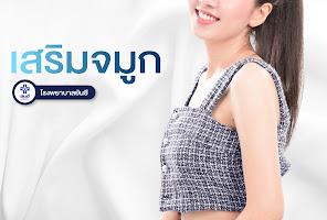Rhinoplasty