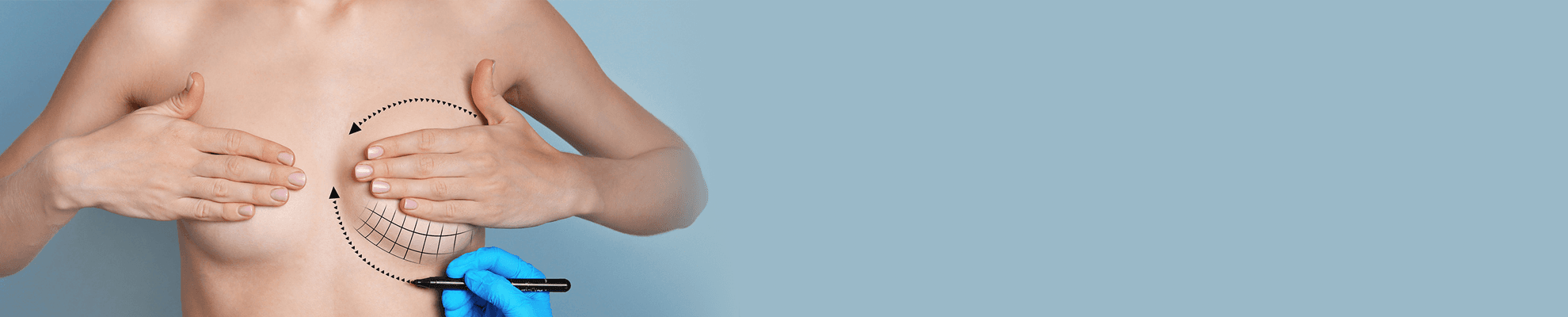 lifting del seno senza Impianti banner