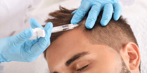 Cellule Staminali per il Cuoio Capelluto