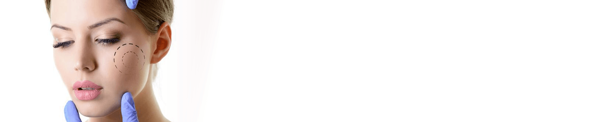 Lipofilling facciale banner