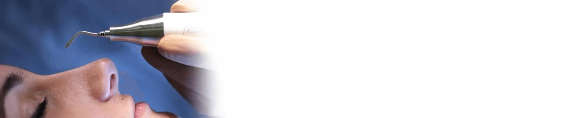 Rinoplastica Ultrasonica banner