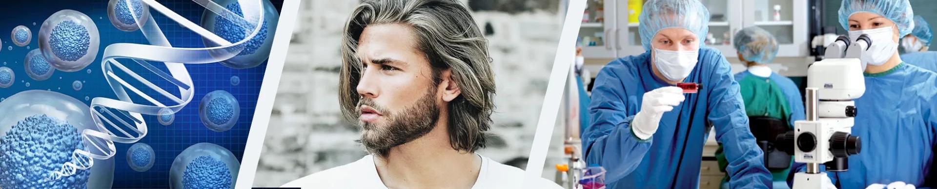 FUE Cellules Souches — Esthetic Planet