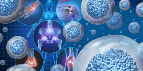 Ortopedia Rigenerativa con Cellule Staminali