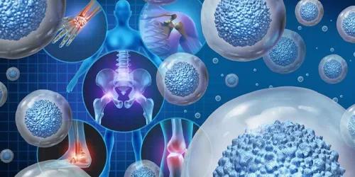 Stem Cells Regenerative Orthopedics