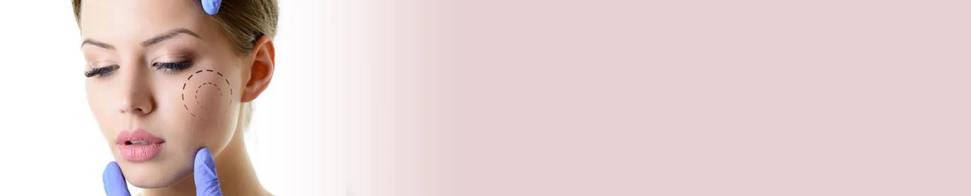 Bichectomía — Esthetic Planet